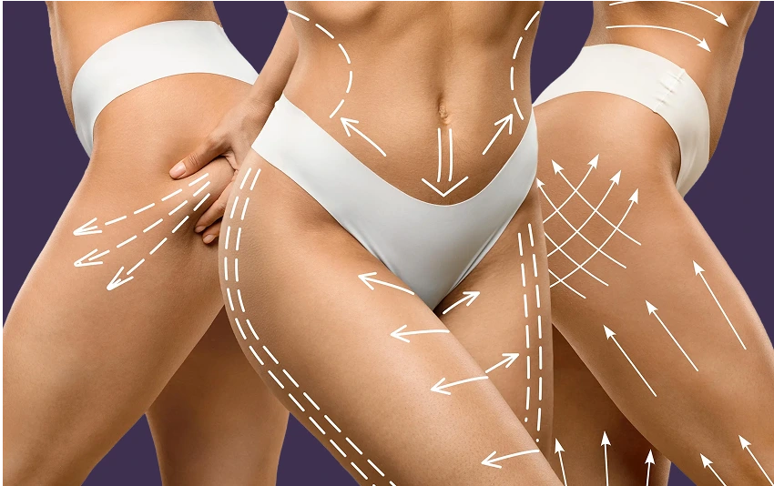 Non-Surgical Post Weight Loss Skin Tightening in Boca Raton, FL